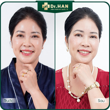Khách hàng Hà My hồi xuân với chăm sóc & trẻ hóa da tại Dr. HAN