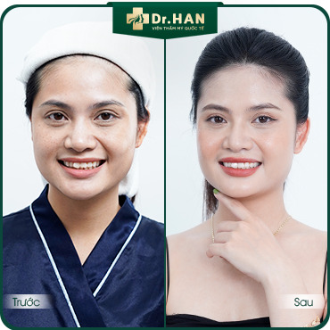 Khách hàng Phương Hà hồi xuân với chăm sóc & trẻ hóa da tại Dr. HAN