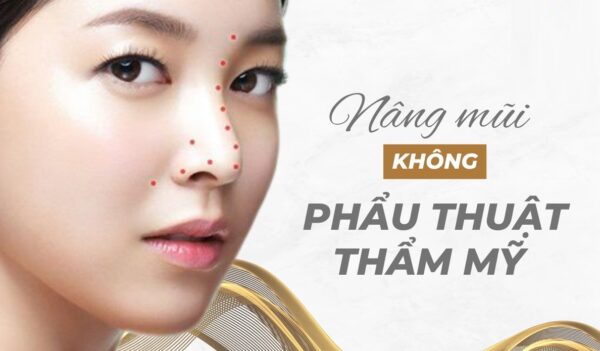 phương pháp nâng mũi không phẫu thuật