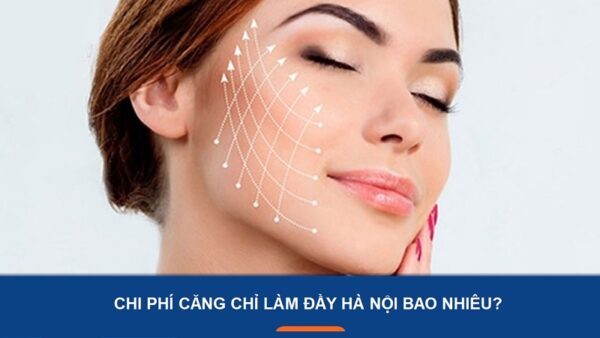 chi phí căng chỉ làm đầy hà nội