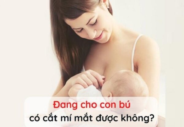 đang cho con bú có cắt mí mắt được không