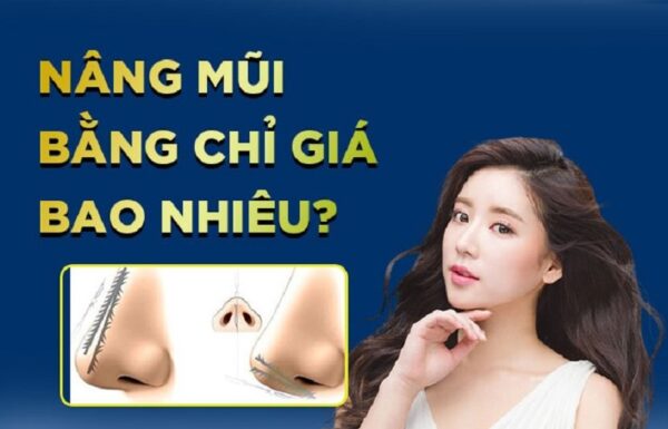 Nâng mũi bằng chỉ giá bao nhiêu