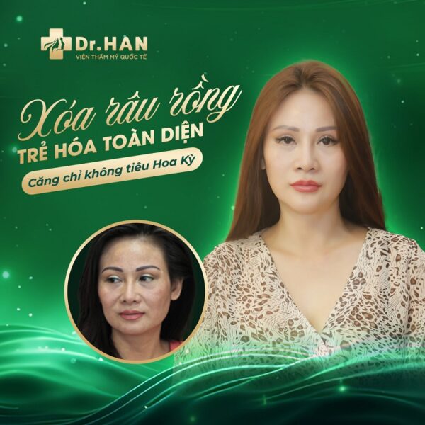 điều trị tàn nhang tại spa, trị tàn nhang tại spa, trị tàn nhang ở đâu tốt nhất