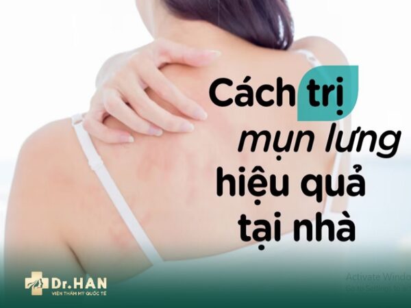 trị mụn lưng tại nhà